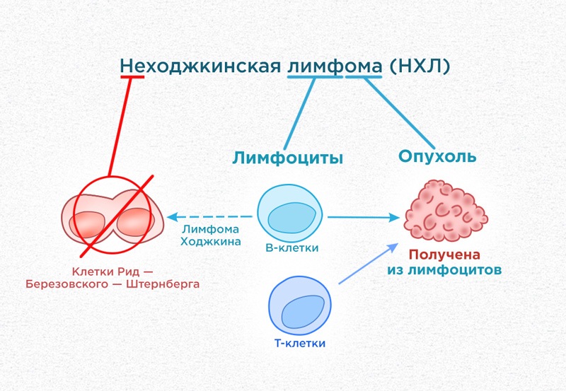 Лимфома Ходжкина составляет 5-7% от всей онкологии у детей, занимая примерно 5 место в структуре заболеваемости. Среди всех случаев лимфомы на долю ЛХ приходится около 40%.