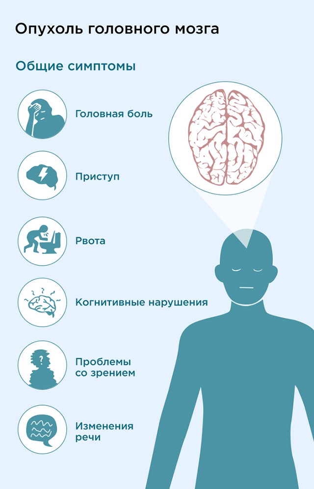 Опухоль головного мозга первый симптом
