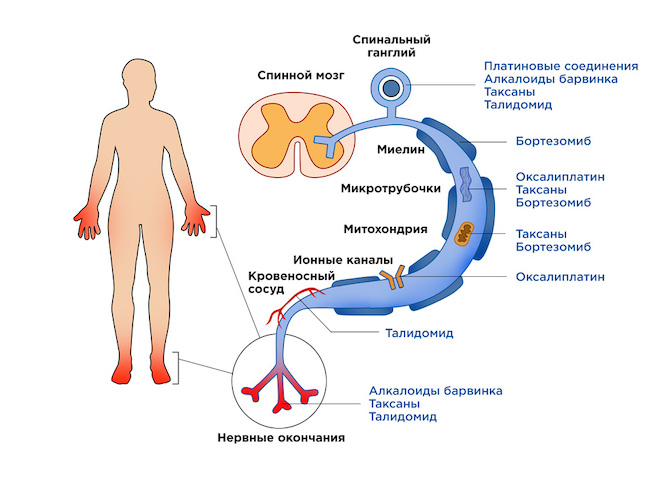 Большинство противоопухолевых препаратов оказывают нейротоксическое воздействие на периферическую нервную систему.