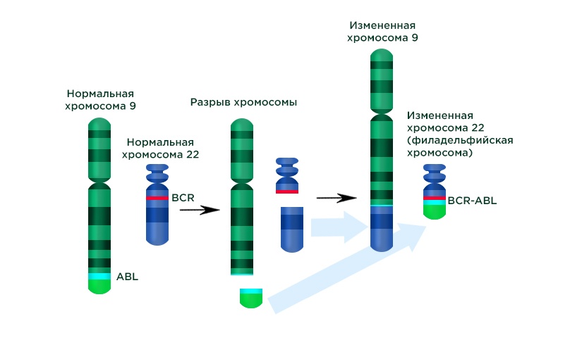 Хромосомные аномалии (схема).